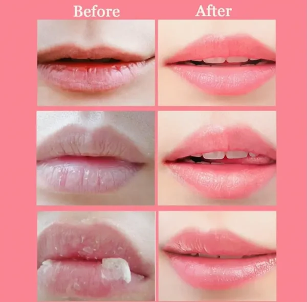 Honey Lip Honey Pot, Nourishing Lip Care