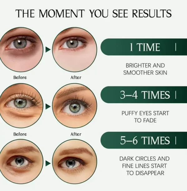 Tiepetly's Under Eye Masks, Green Tea Infused