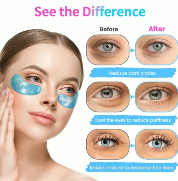 Under Eye Pads (32 Pairs) - Collagen-Loaded, Anti-Puffiness & Dark Spot Treatment