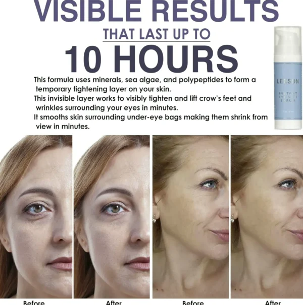 Instant Eye Lift Serum - Immediate Results for Lines & Wrinkles