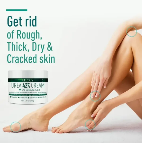 Carbamide 42 Percent Heel Cream for Cracked Feet, 5.3 Oz