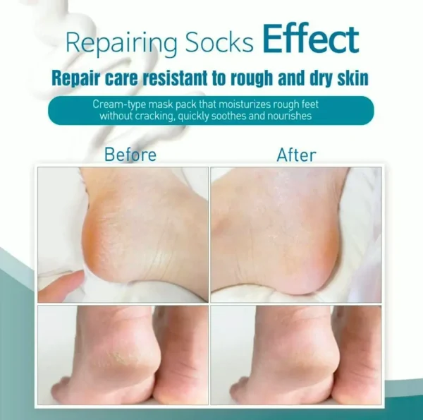 Deep Heel Repair Mask (6-Pack) | Coconut + Milk Extract + Hyaluronic Acid