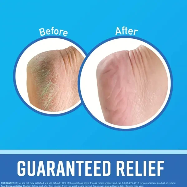 O'Keeffe's Moisturizing Feet Cream 6.4 oz