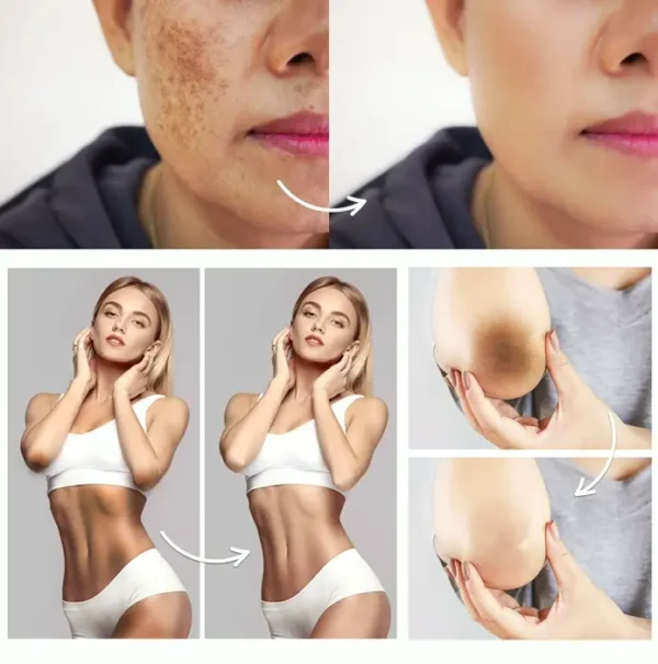 Private Body Spot Corrector - Armpit Treatment for Various Areas