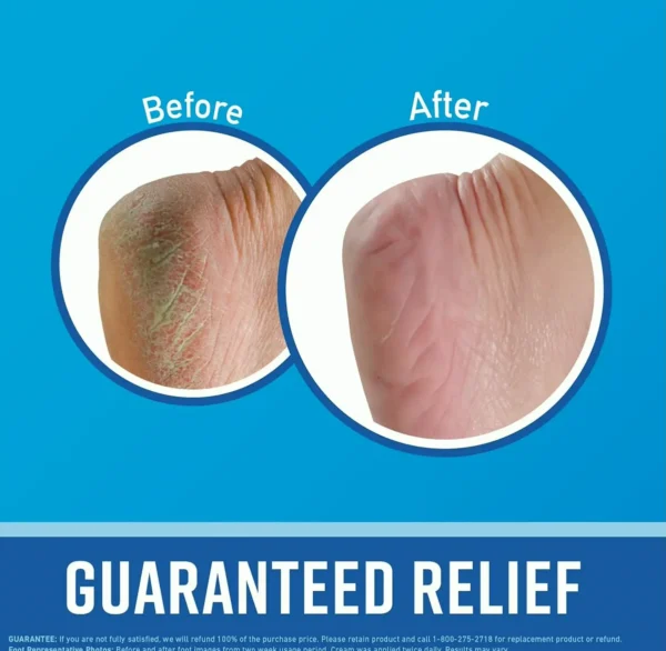 O'Keeffe's Gift set: Lip Repair, Hand Cream & Foot Cream