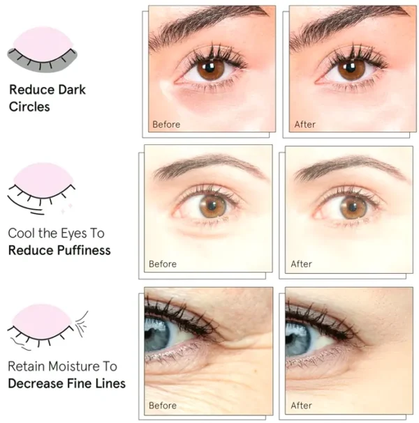Prize Winning Under Eye Mask - Minimize Puffy Eyes